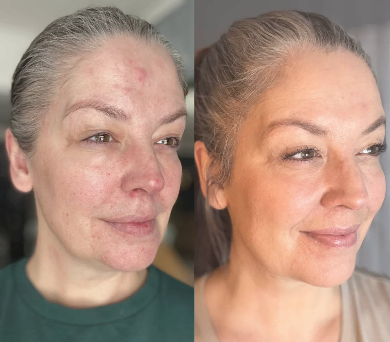 Vrimlo 7 Color LED Therapy Mask for Effortlessly Smoother Skin Beauty