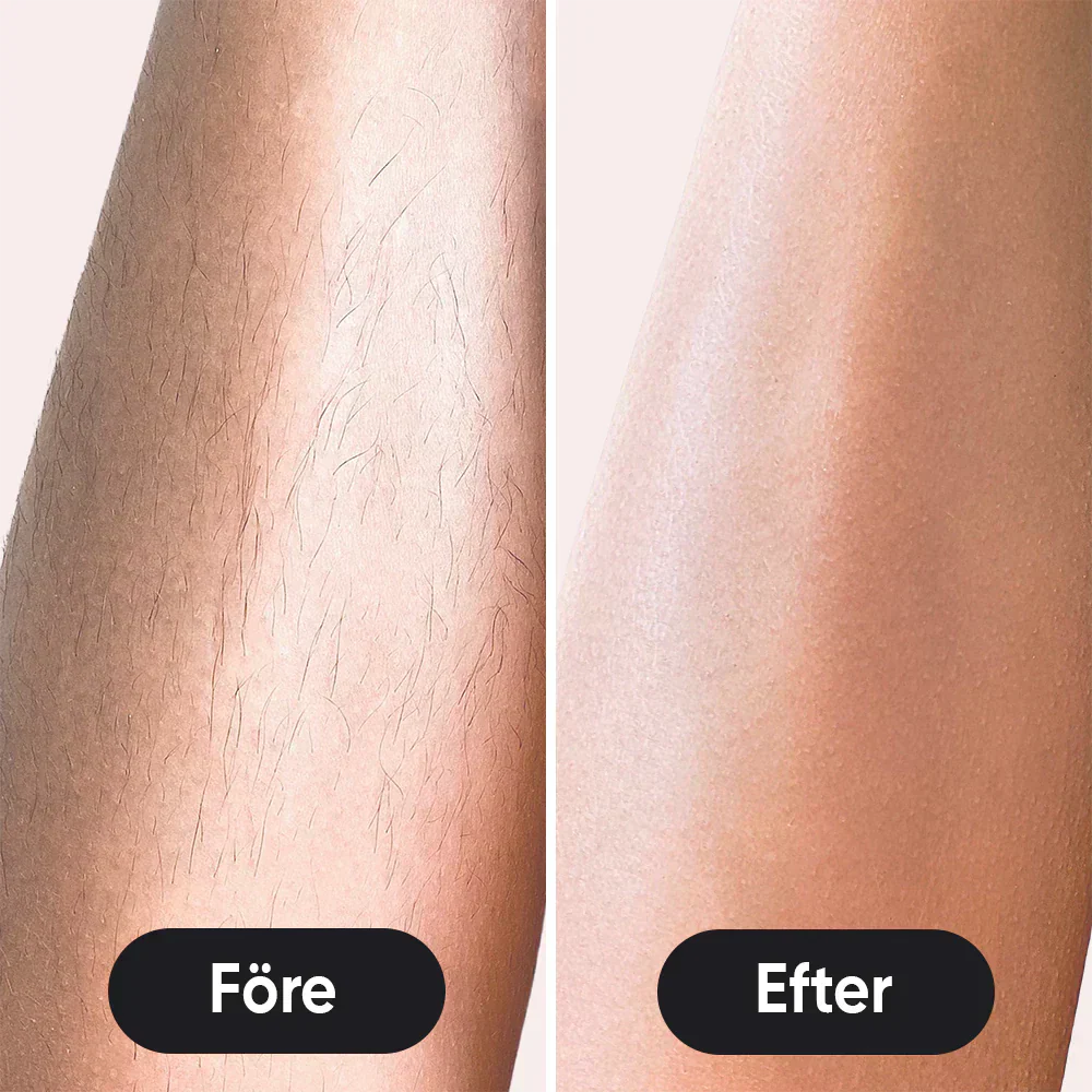 IPL - Permanent hair removal beauty
