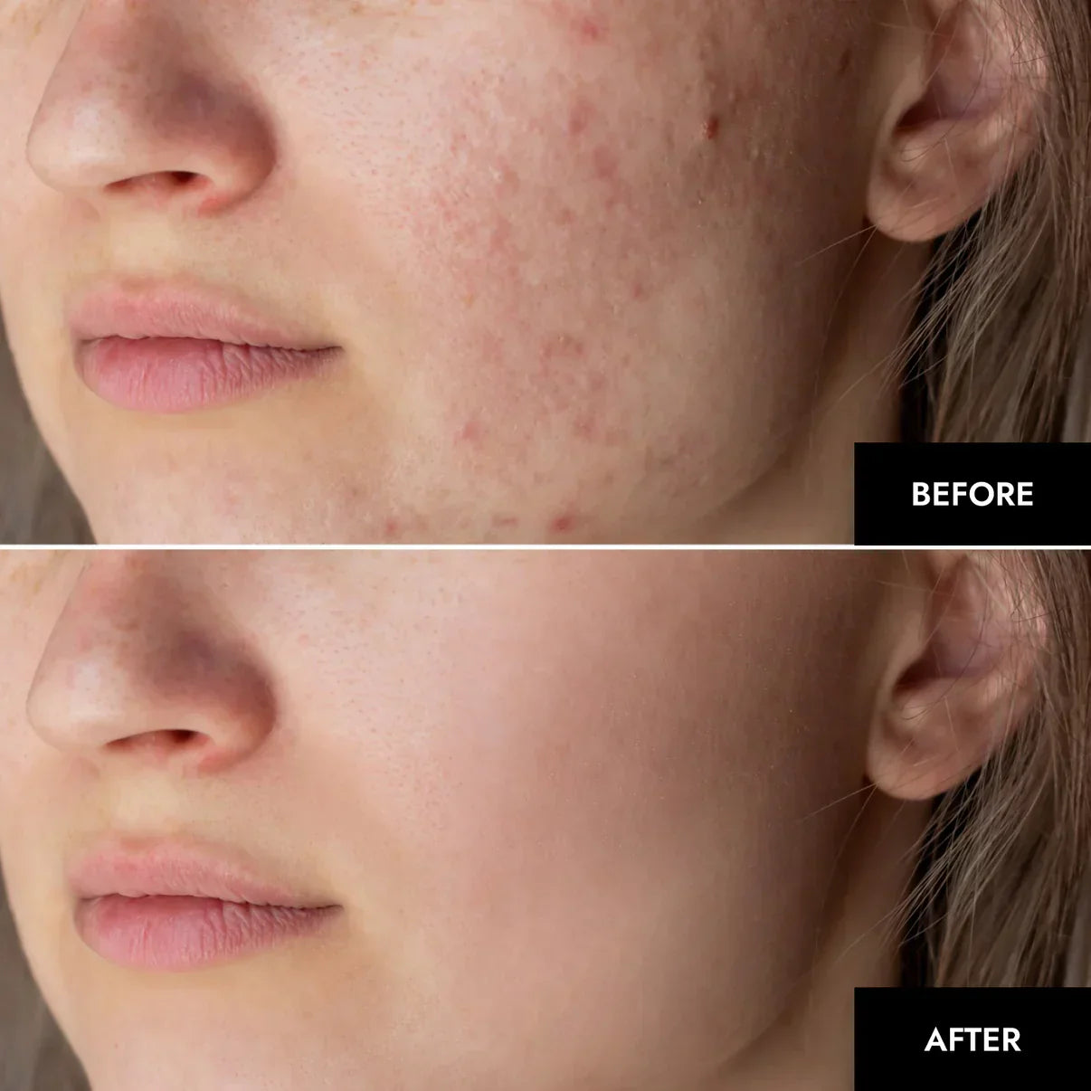 Nanofiber Collagen Mask: Clinically Proven Hydration & Wrinkle Reduction beauty