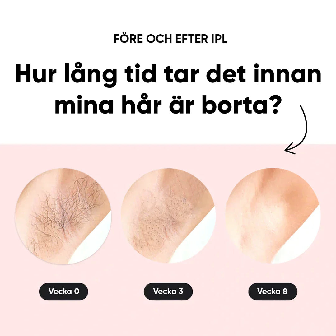 IPL - Permanent hair removal beauty