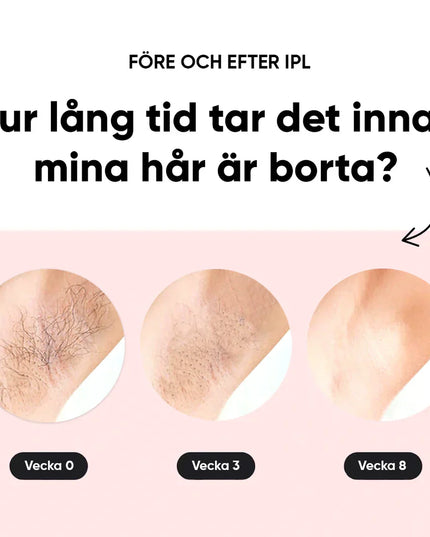 IPL - Permanent hair removal beauty