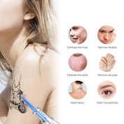 Smart Laser Tattoo Removal Pen – Remove Moles, Freckles, Acne & Tattoos Safely Beauty