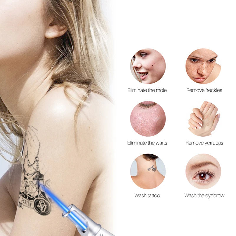 Smart Laser Tattoo Removal Pen – Remove Moles, Freckles, Acne & Tattoos Safely Beauty