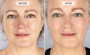 Vrimlo 7 Color LED Therapy Mask for Effortlessly Smoother Skin Beauty