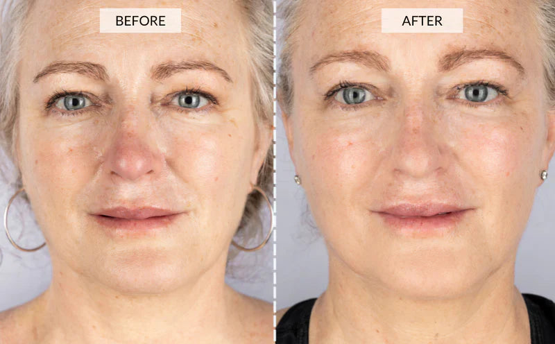 Vrimlo 7 Color LED Therapy Mask for Effortlessly Smoother Skin Beauty