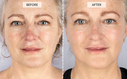 Vrimlo 7 Color LED Therapy Mask for Effortlessly Smoother Skin Beauty