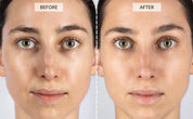 Vrimlo 7 Color LED Therapy Mask for Effortlessly Smoother Skin Beauty