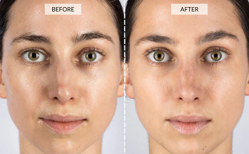 Vrimlo 7 Color LED Therapy Mask for Effortlessly Smoother Skin Beauty