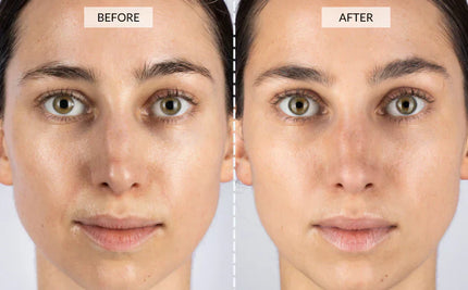 Vrimlo 7 Color LED Therapy Mask for Effortlessly Smoother Skin Beauty
