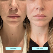 Nanofiber Collagen Mask: Clinically Proven Hydration & Wrinkle Reduction beauty