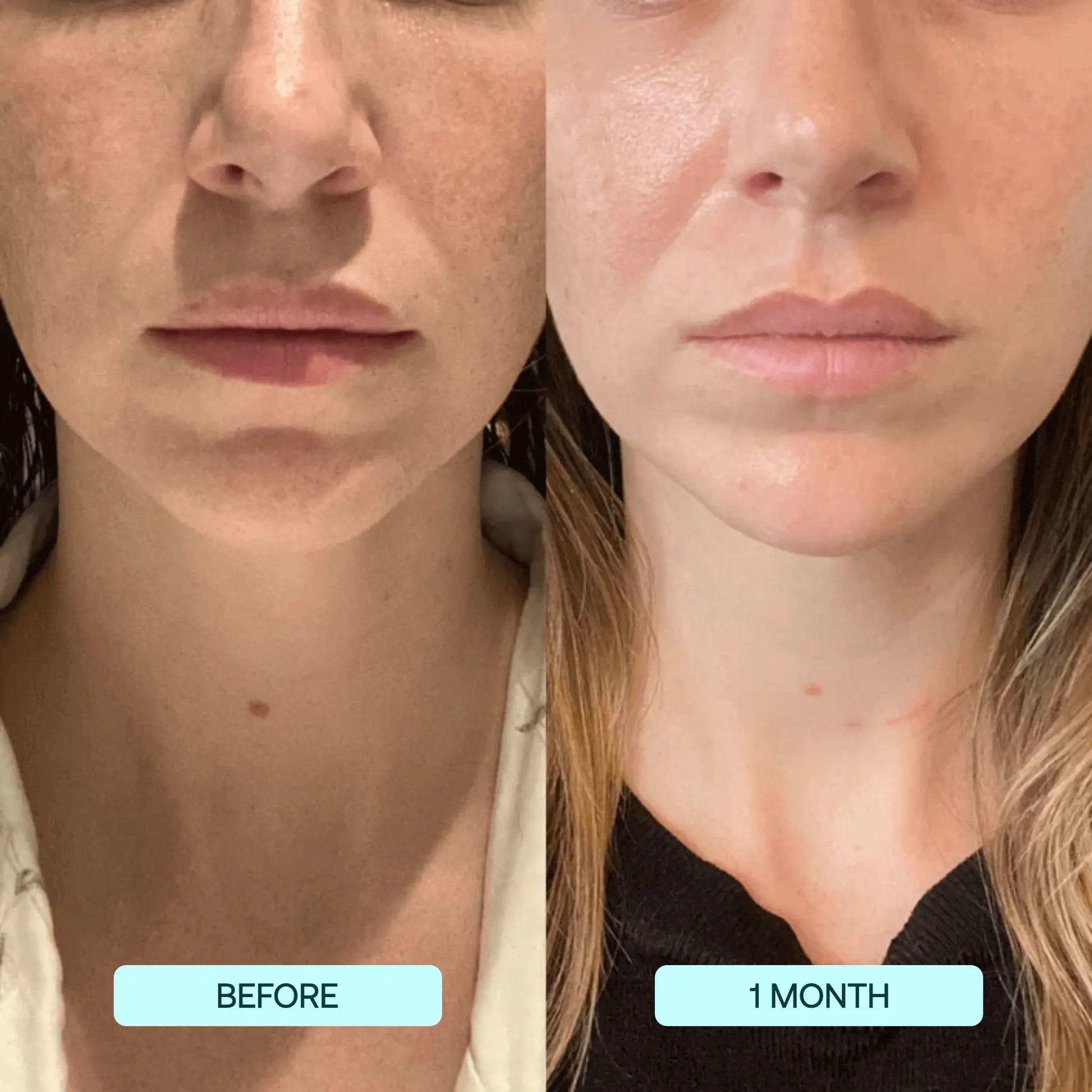 Nanofiber Collagen Mask: Clinically Proven Hydration & Wrinkle Reduction beauty