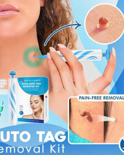 Auto tag removal kit - remove skin tags Beauty