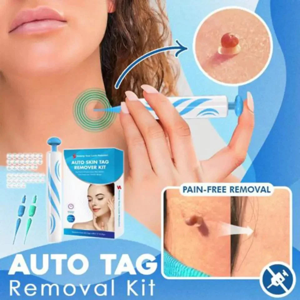 Auto tag removal kit - remove skin tags Beauty