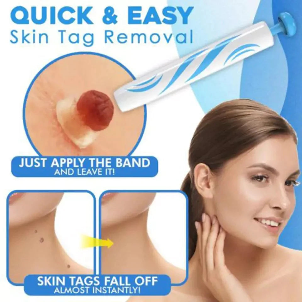Auto tag removal kit - remove skin tags Beauty