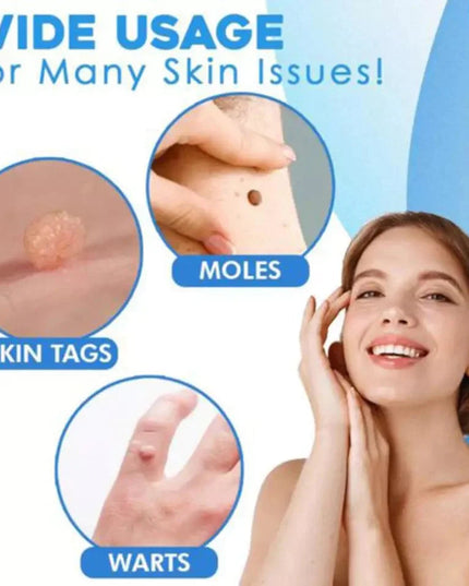 Auto tag removal kit - remove skin tags Beauty