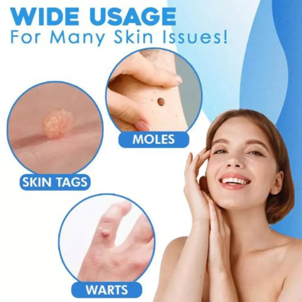 Auto tag removal kit - remove skin tags Beauty