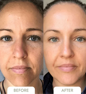 Nanofiber Collagen Mask: Clinically Proven Hydration & Wrinkle Reduction beauty