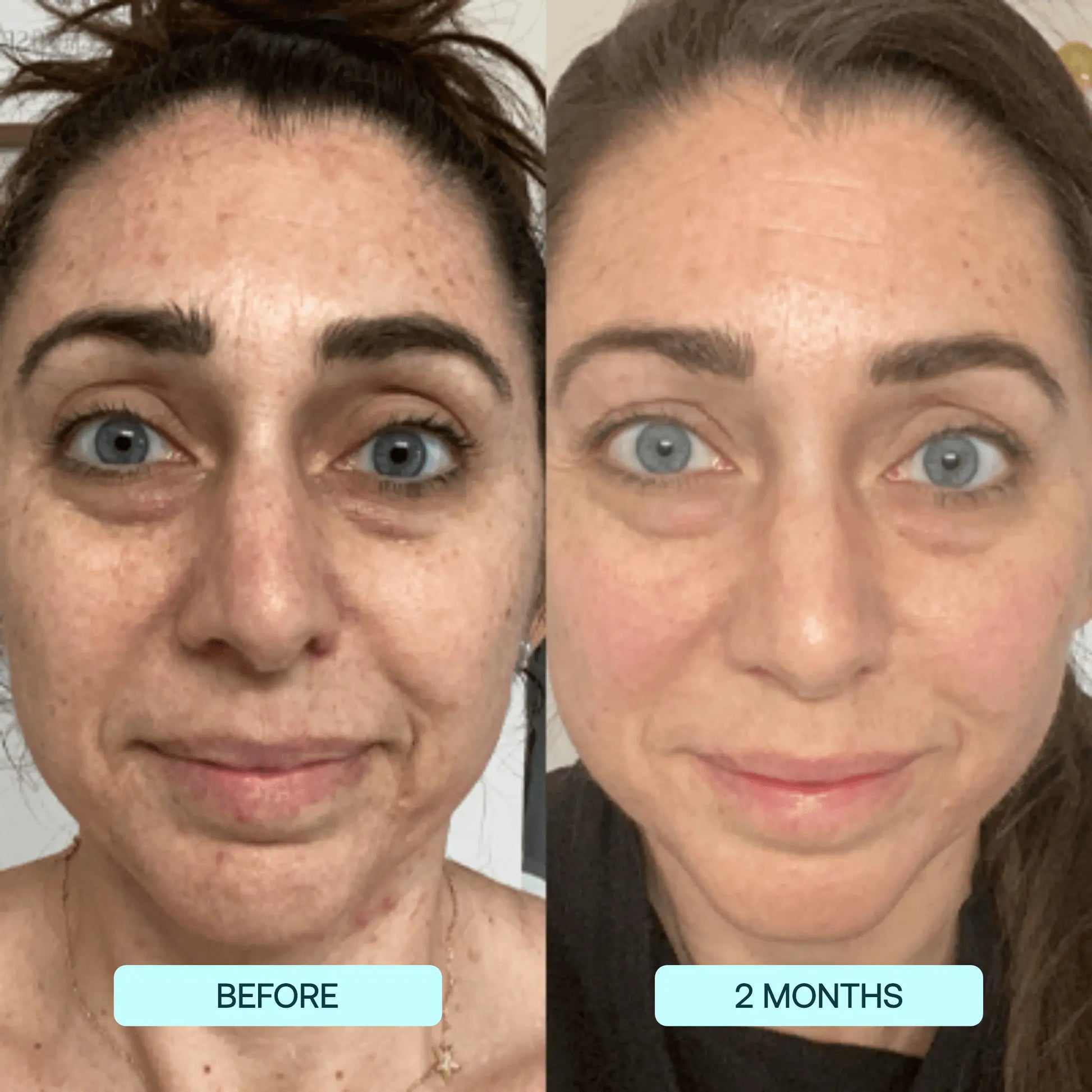 Nanofiber Collagen Mask: Clinically Proven Hydration & Wrinkle Reduction beauty
